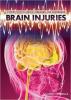 Cover image of Brain injuries